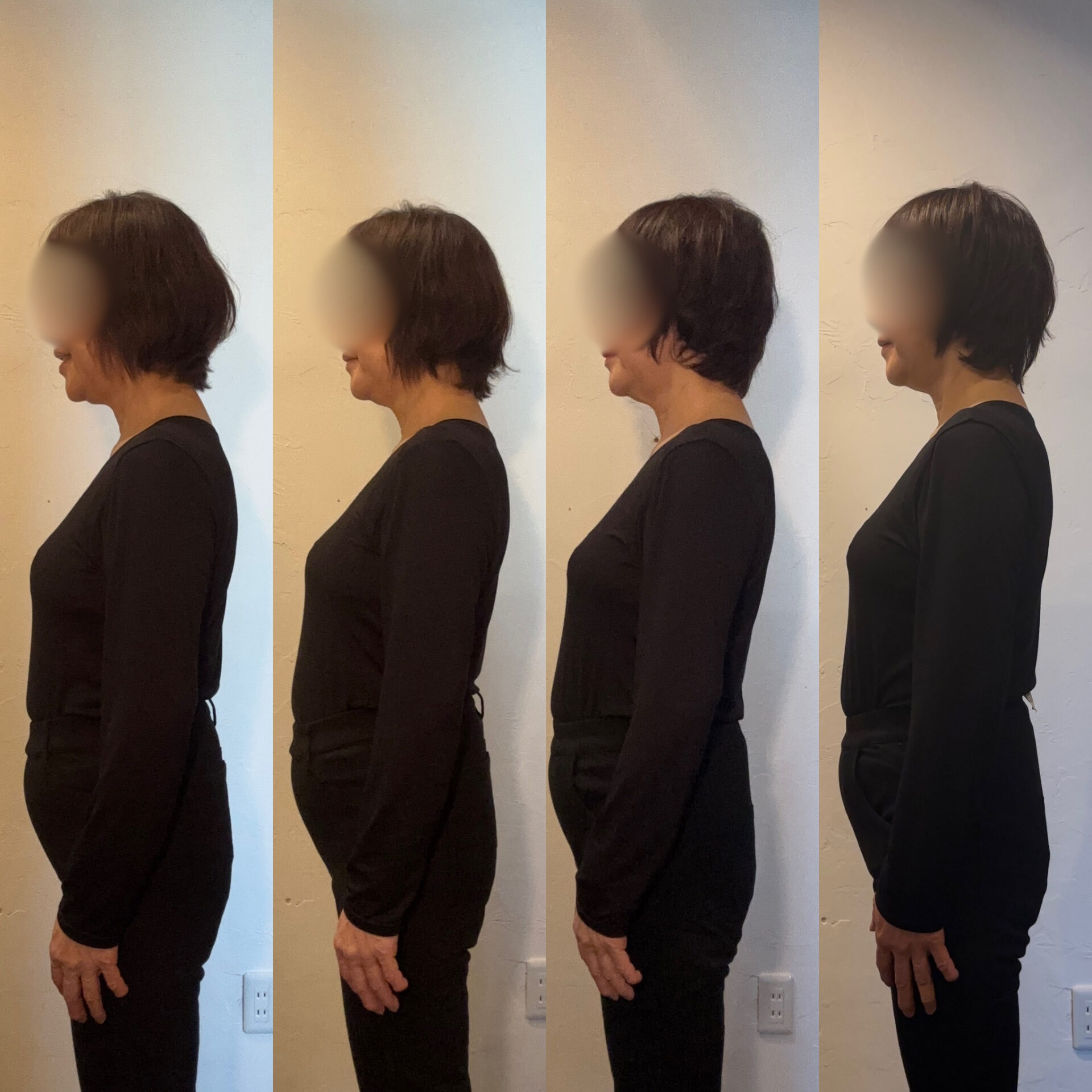 全身美容鍼_姿勢改善_呼吸_beforeafter.jpg